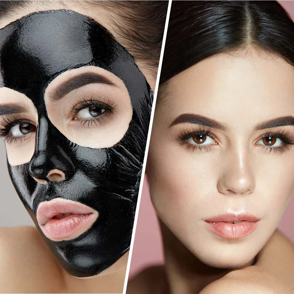 Tiefenreinigende schwarze Maske mit Aktivkohle – 100 ml