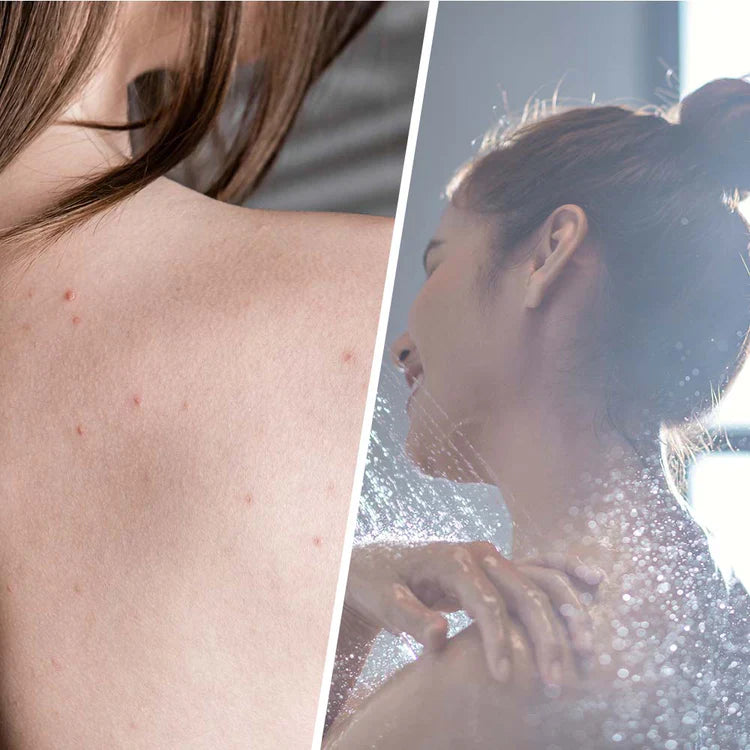 Salicylic Scrub mit Teebaum zur Hautentgiftung 250 ml