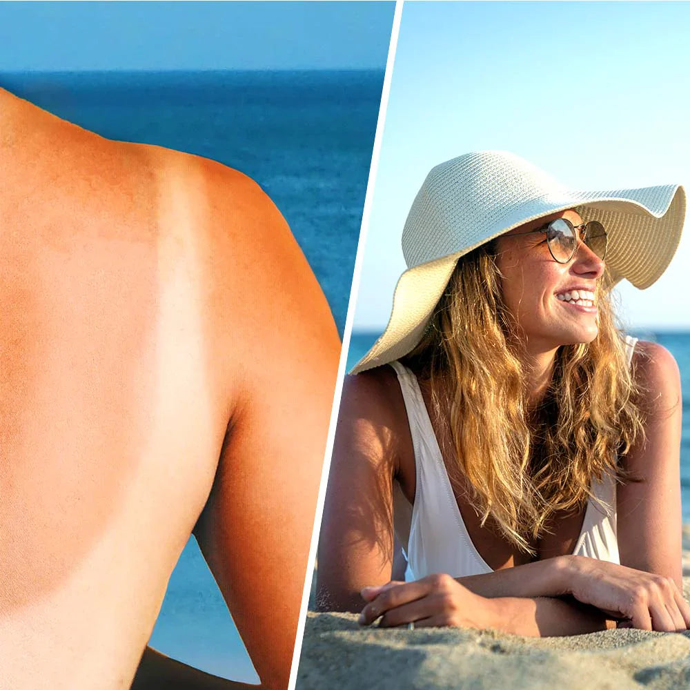 Beruhigende Lotionspray mit Hyaluronsäure nach der Sonne - 200 ml