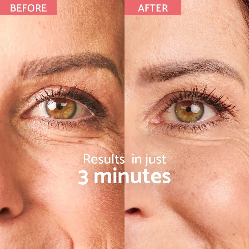 Remescar Instant Wrinkle Corrector - Wrinkle Corrector mit sofortigem Effekt (180 Anwendungen)