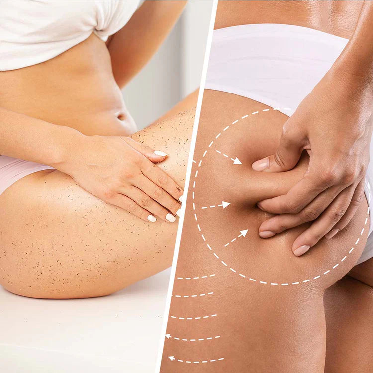 Niacin Anti-Cellulite-Peeling mit Kokosnuss zum Festen und Glätten der Haut 250 ml