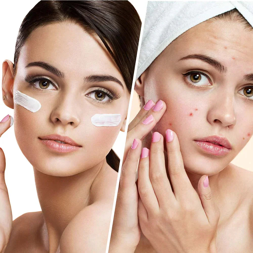 Clear Balance – Feuchtigkeitsspendende Gesichtscreme gegen Pickel und Unreinheiten mit Niacinamid 50 ml