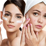 Clear Balance – Feuchtigkeitsspendende Gesichtscreme gegen Pickel und Unreinheiten mit Niacinamid 50 ml